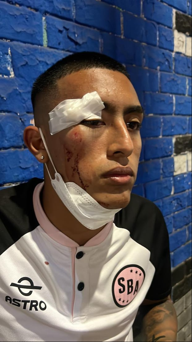 Así quedó el rostro de Fabrizio Roca luego del ataque que sufrió este domingo. (Foto: Gustavo Peralta)