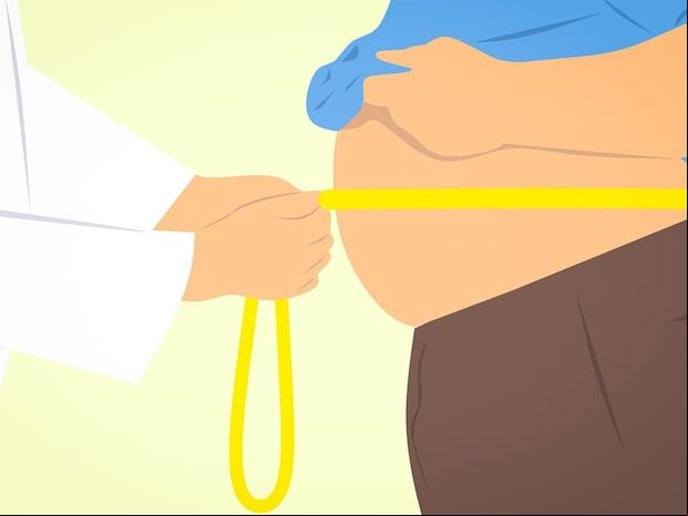 En esta imagen se aprecia a un hombre con un doctor, el cual le está midiendo su barriga. (Foto: Mohamed Hassan / Pixabay)