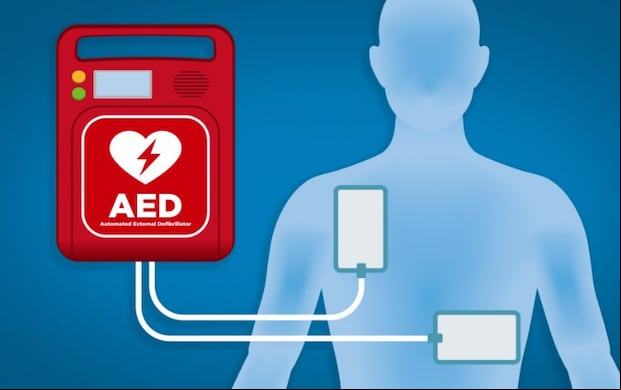 Imágen de cómo funciona el desfibrilador cardíaco (Foto: FDA)