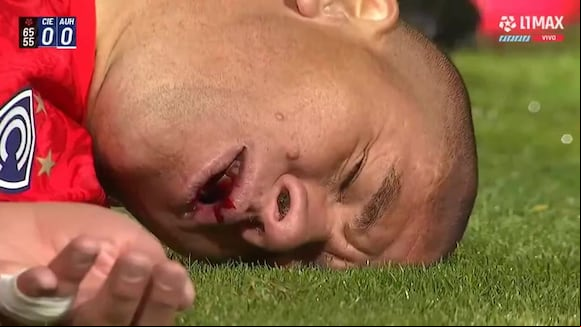 Danilo Ortiz sufrió una grave lesión durante el partido contra Alianza Universidad. (Video: L1 MAX)